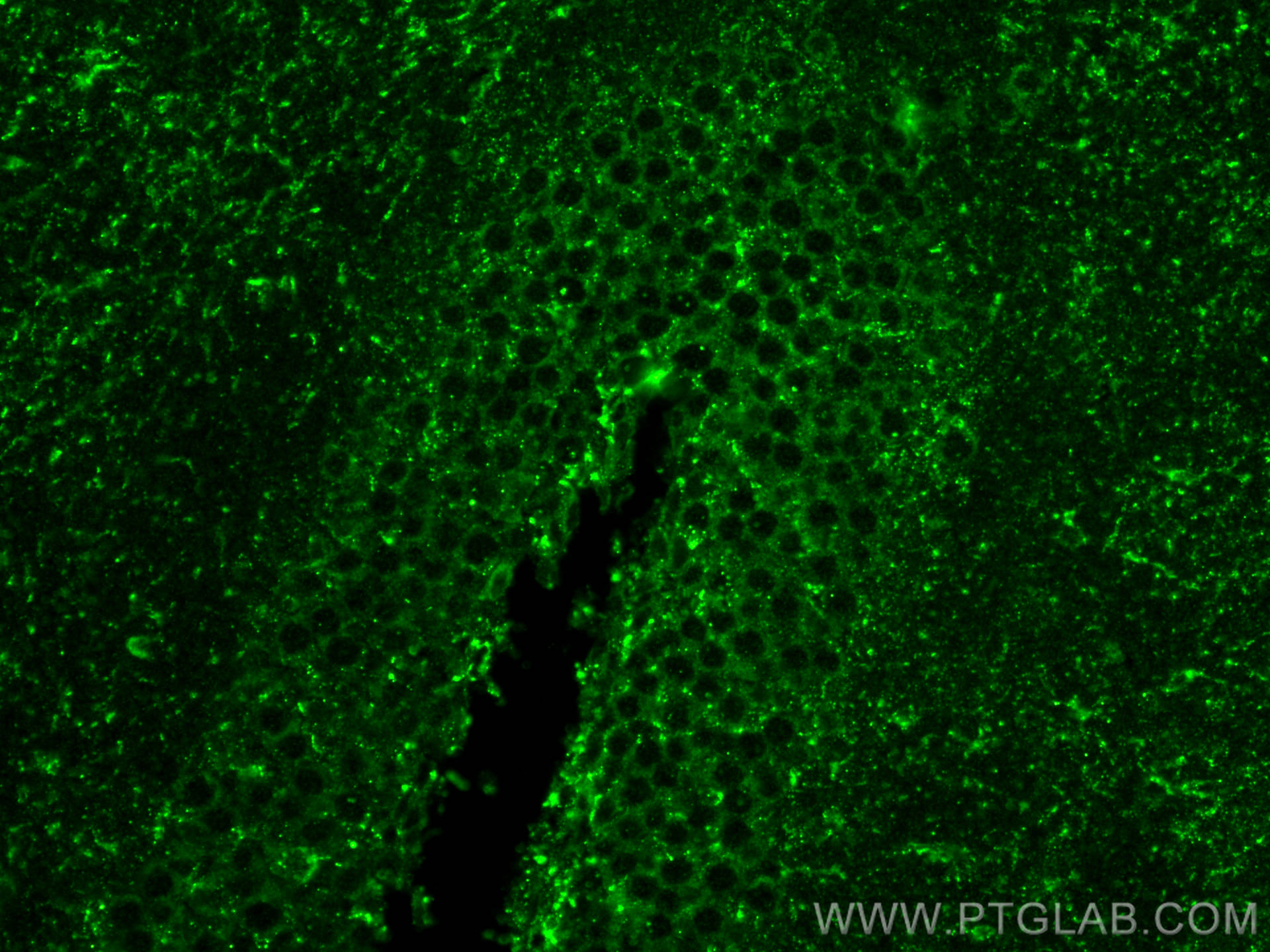 IF Staining of mouse brain using 31486-1-AP