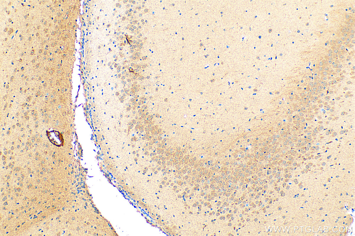 IHC staining of mouse brain using 31486-1-AP