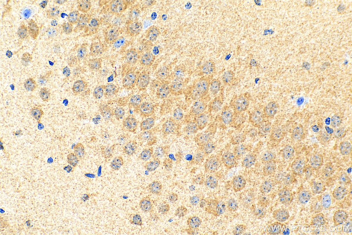 IHC staining of mouse brain using 31486-1-AP