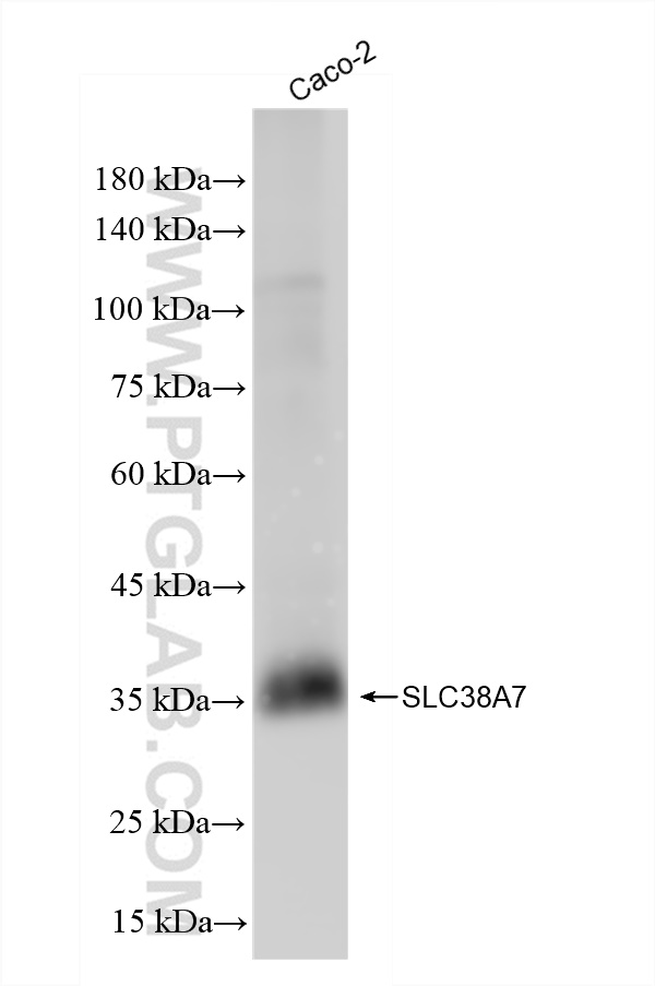 WB analysis of Caco-2 using 83346-6-RR