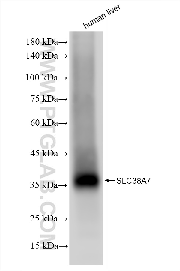 WB analysis of human liver using 83346-6-RR