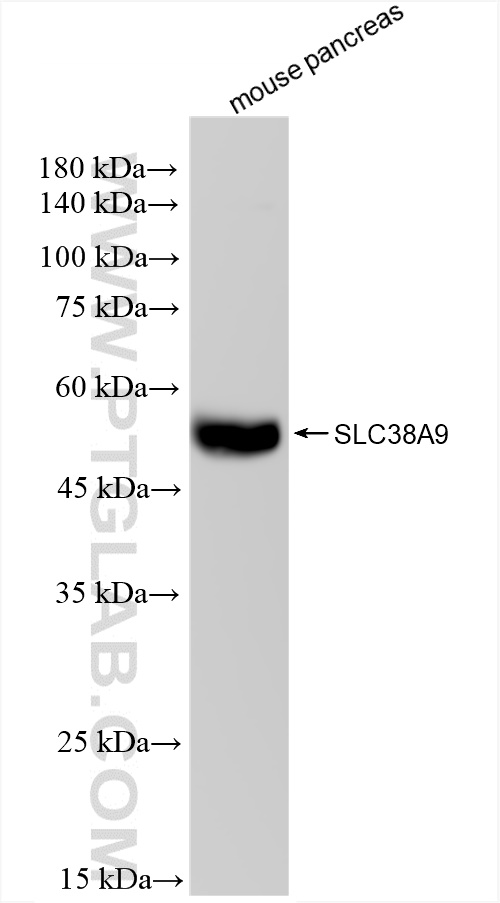 WB analysis of mouse pancreas using 83182-5-RR