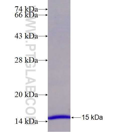 SLC39A1 fusion protein Ag25179 SDS-PAGE