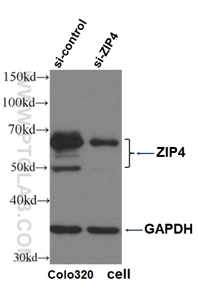 WB analysis of Colo320 cells using 20625-1-AP