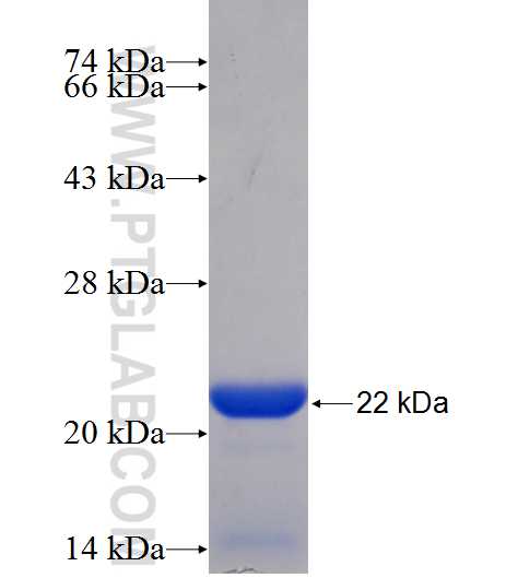 SLC39A7 fusion protein Ag13798 SDS-PAGE