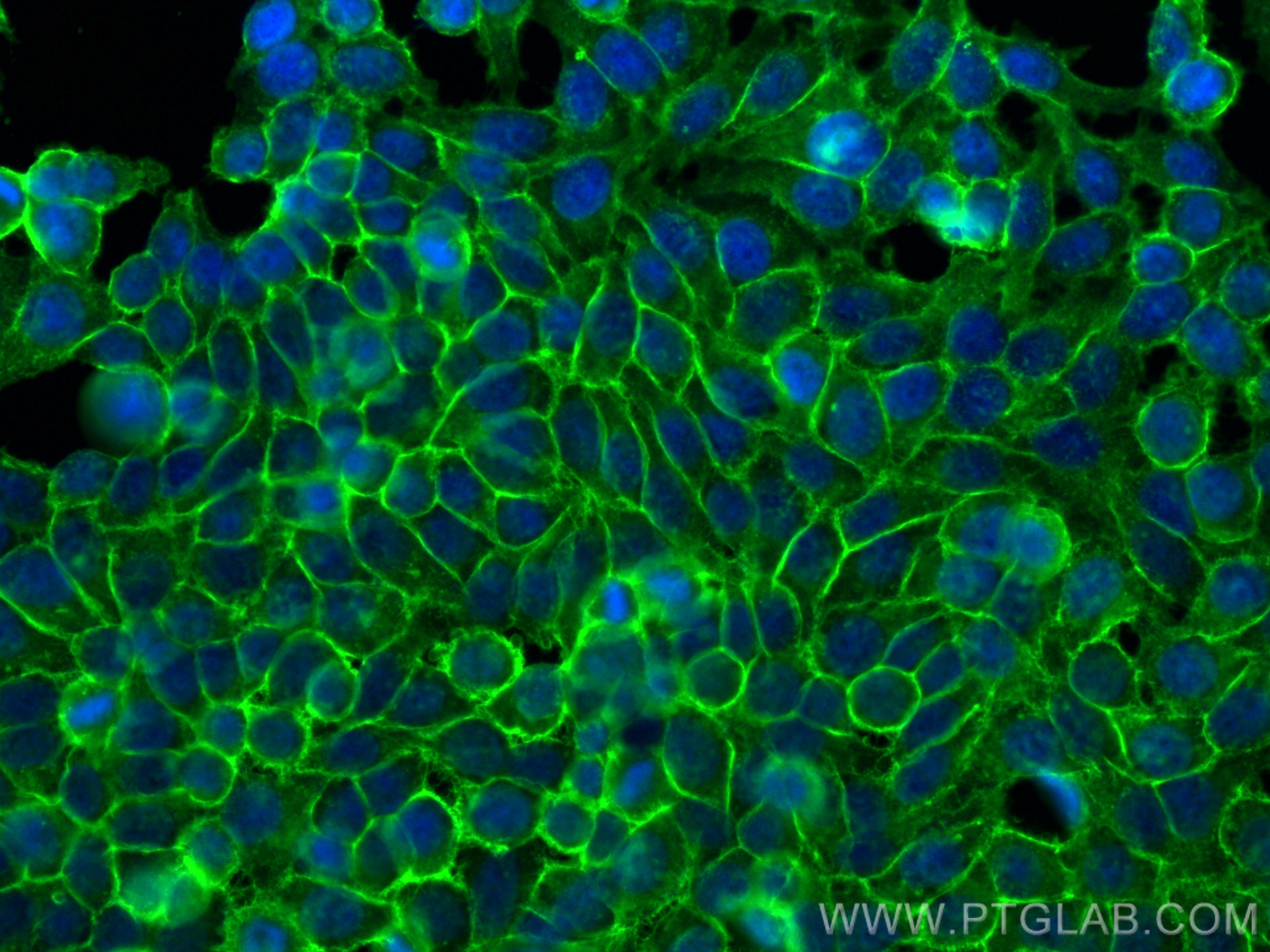 IF Staining of HepG2 using 15193-1-AP