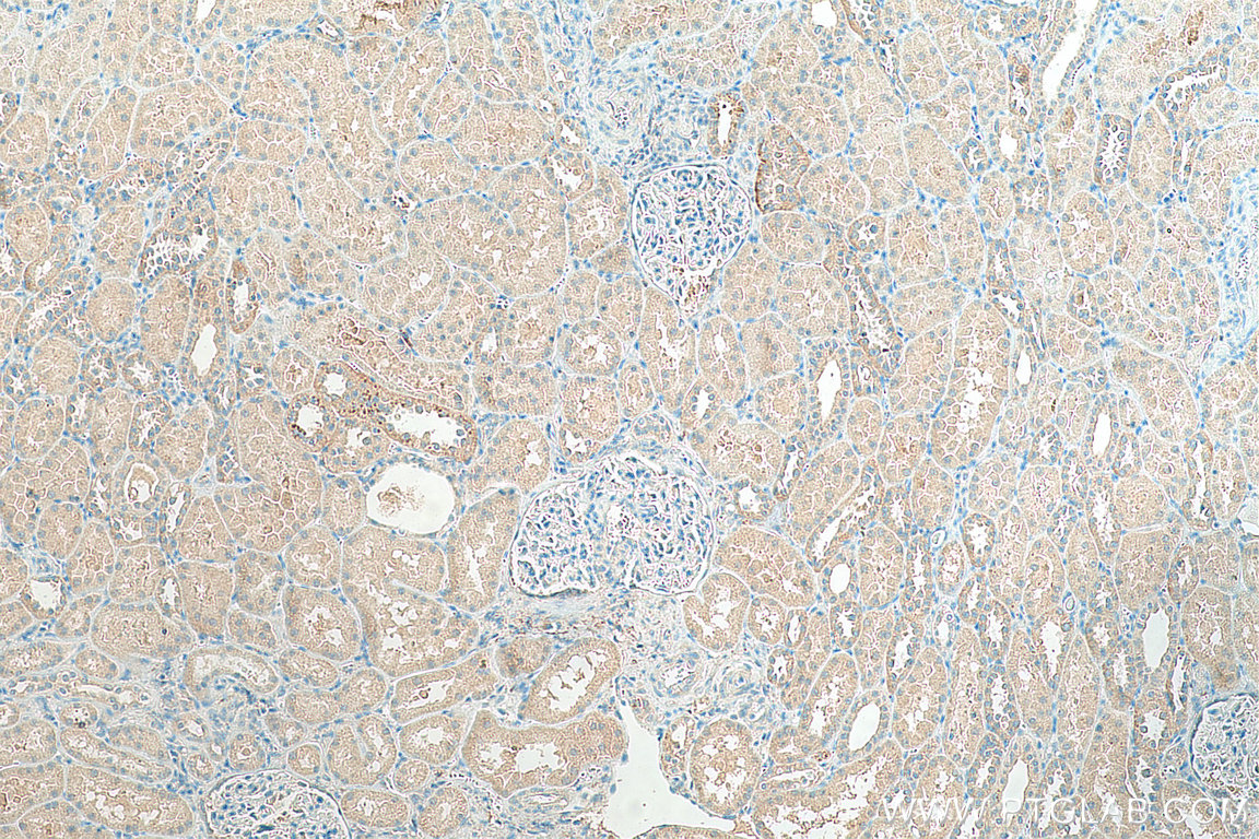 IHC staining of human kidney using 10444-1-AP