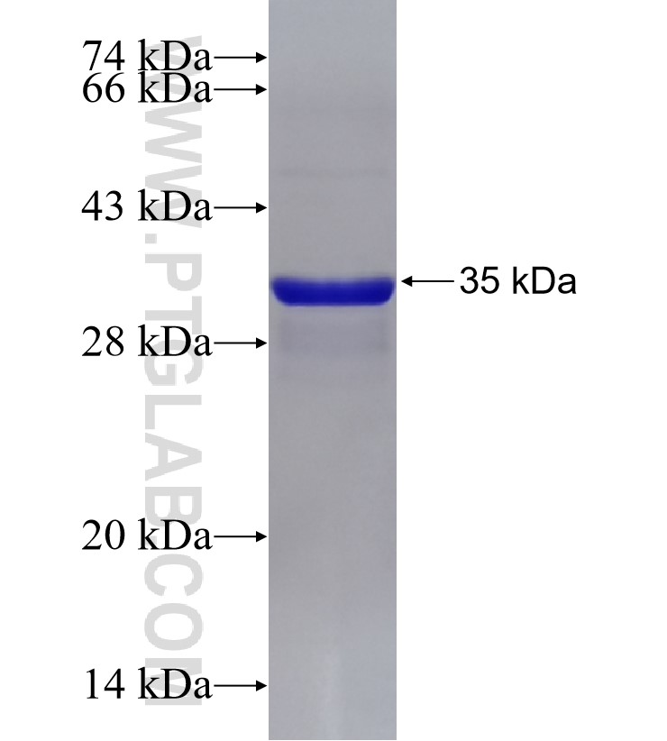 SLC43A1 fusion protein Ag31817 SDS-PAGE