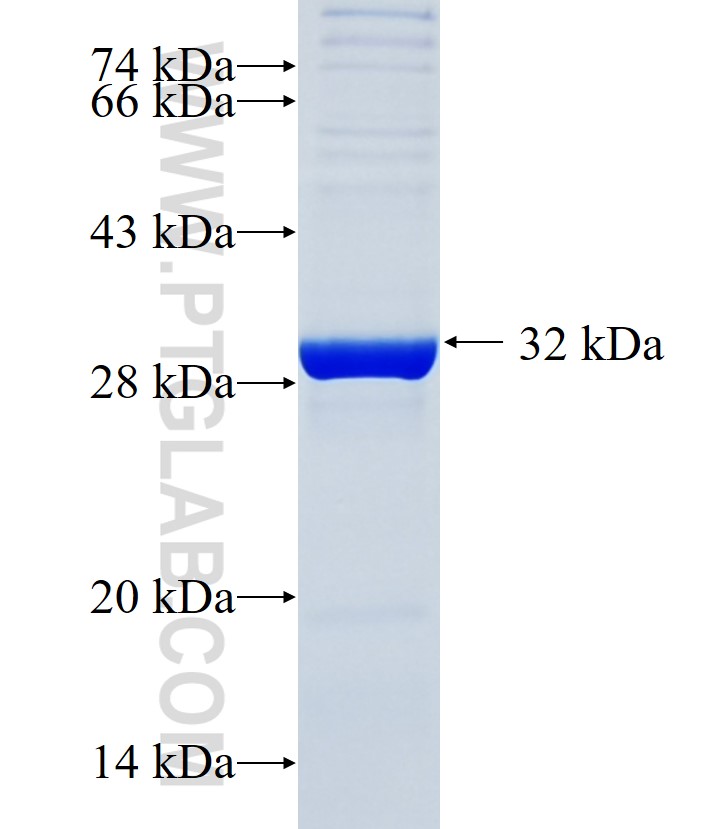 SLC46A3 fusion protein Ag34359 SDS-PAGE