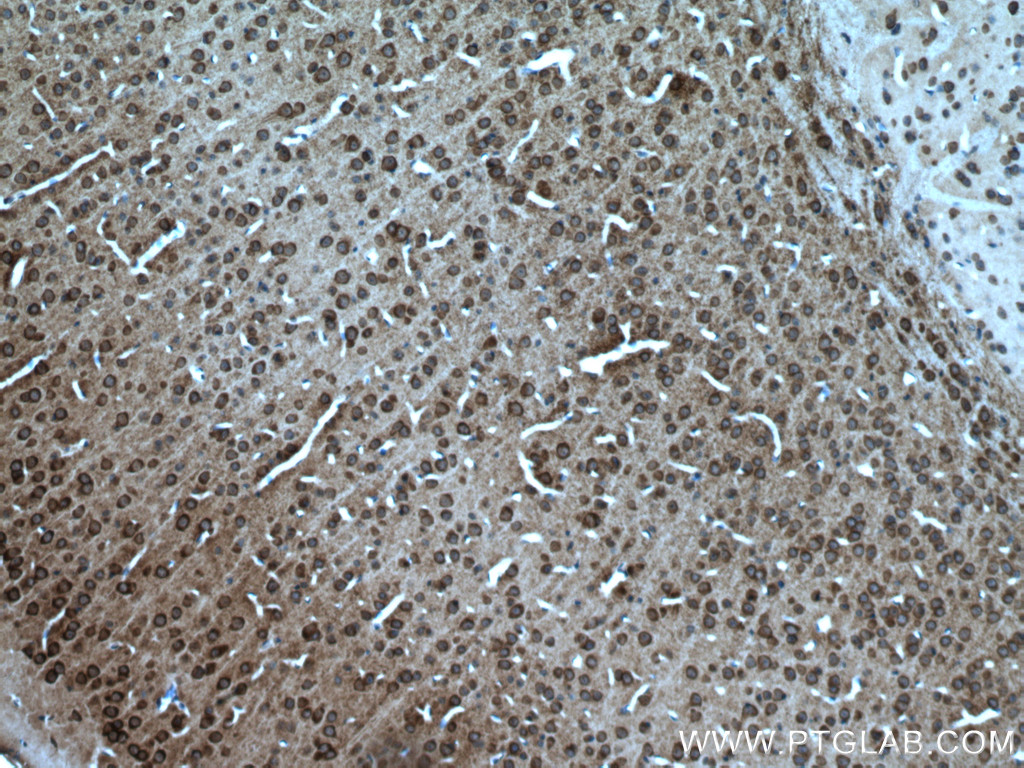 IHC staining of mouse brain using 27197-1-AP