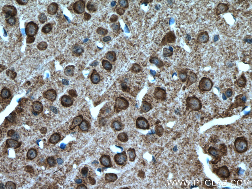 IHC staining of mouse brain using 27197-1-AP