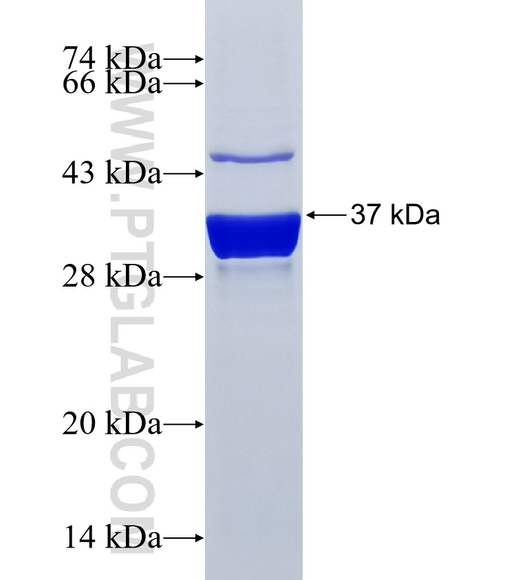 SLC4A10 fusion protein Ag26102 SDS-PAGE