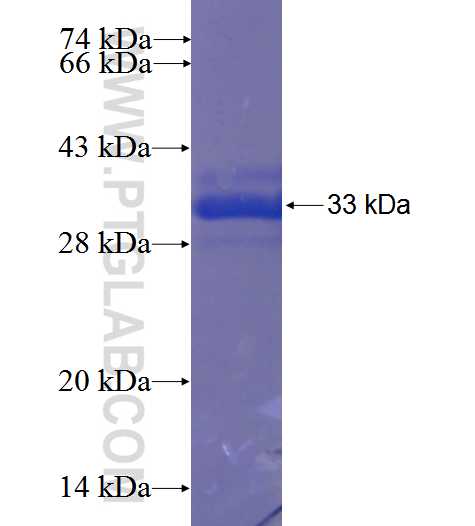 SLC4A5 fusion protein Ag23558 SDS-PAGE