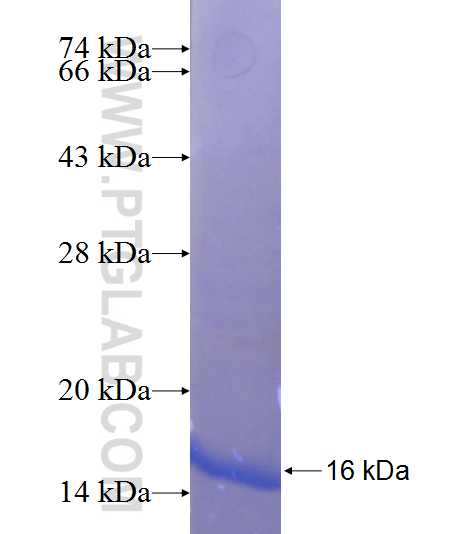 SLC4A5 fusion protein Ag23569 SDS-PAGE