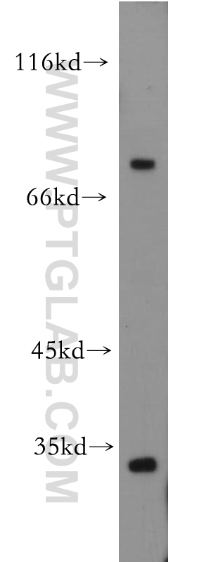 WB analysis of mouse brain using 21628-1-AP