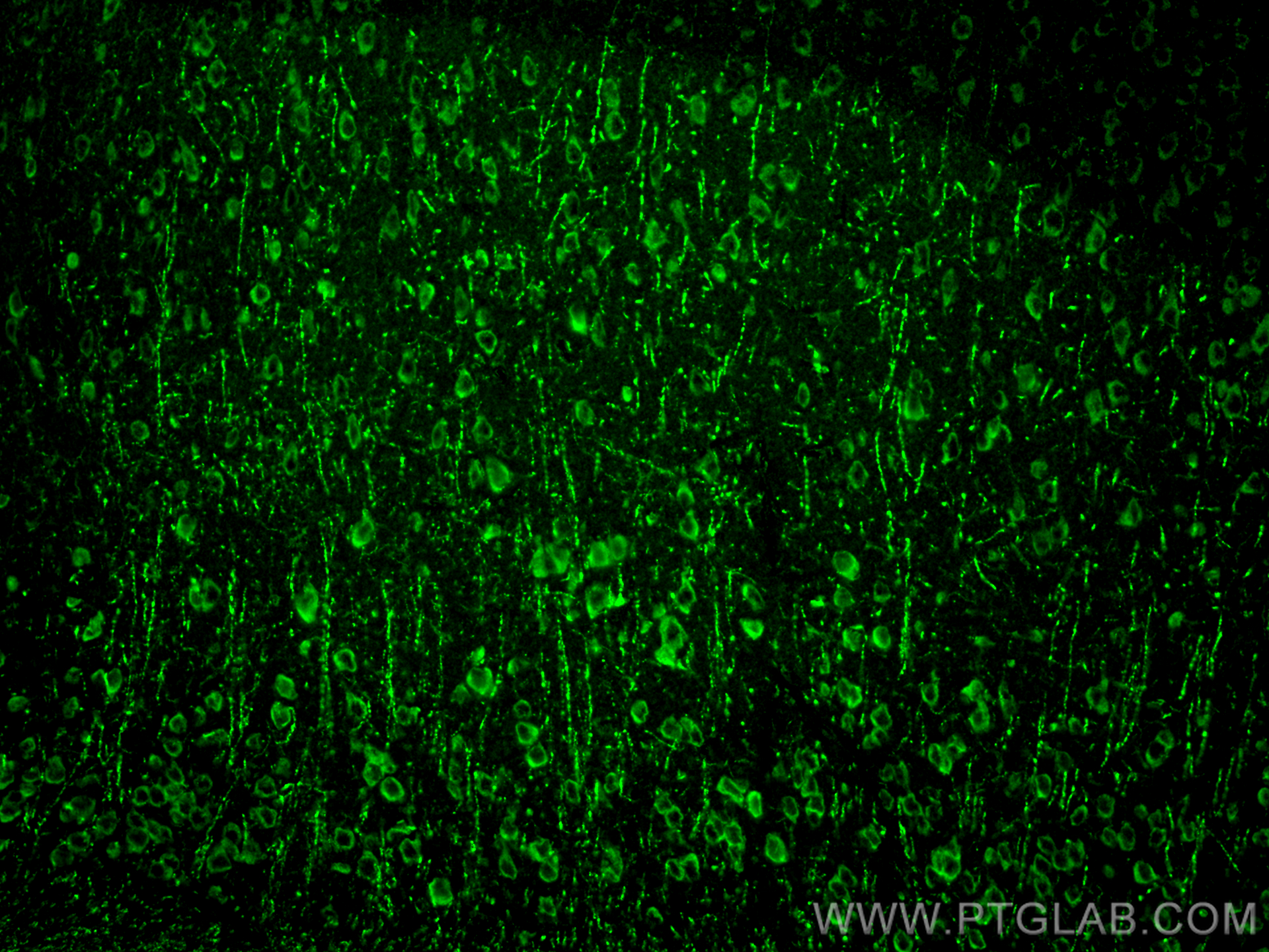 IF Staining of mouse brain using 21848-1-AP (same clone as 21848-1-PBS)