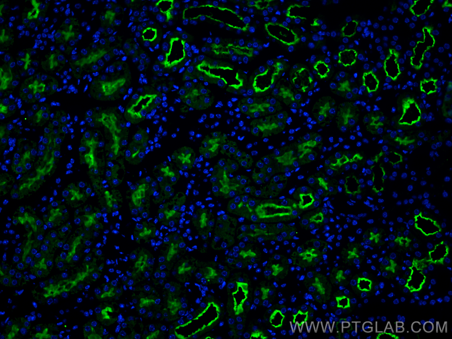 IF Staining of mouse kidney using 21433-1-AP