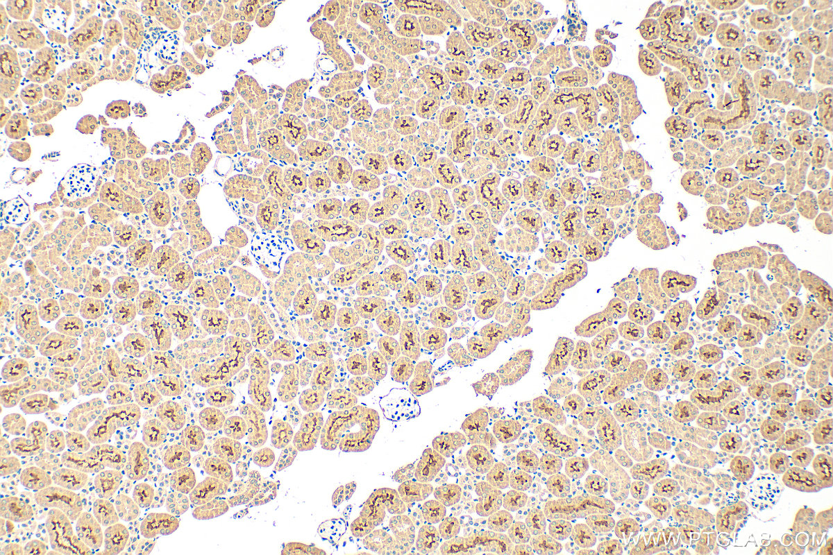 IHC staining of mouse kidney using 21433-1-AP