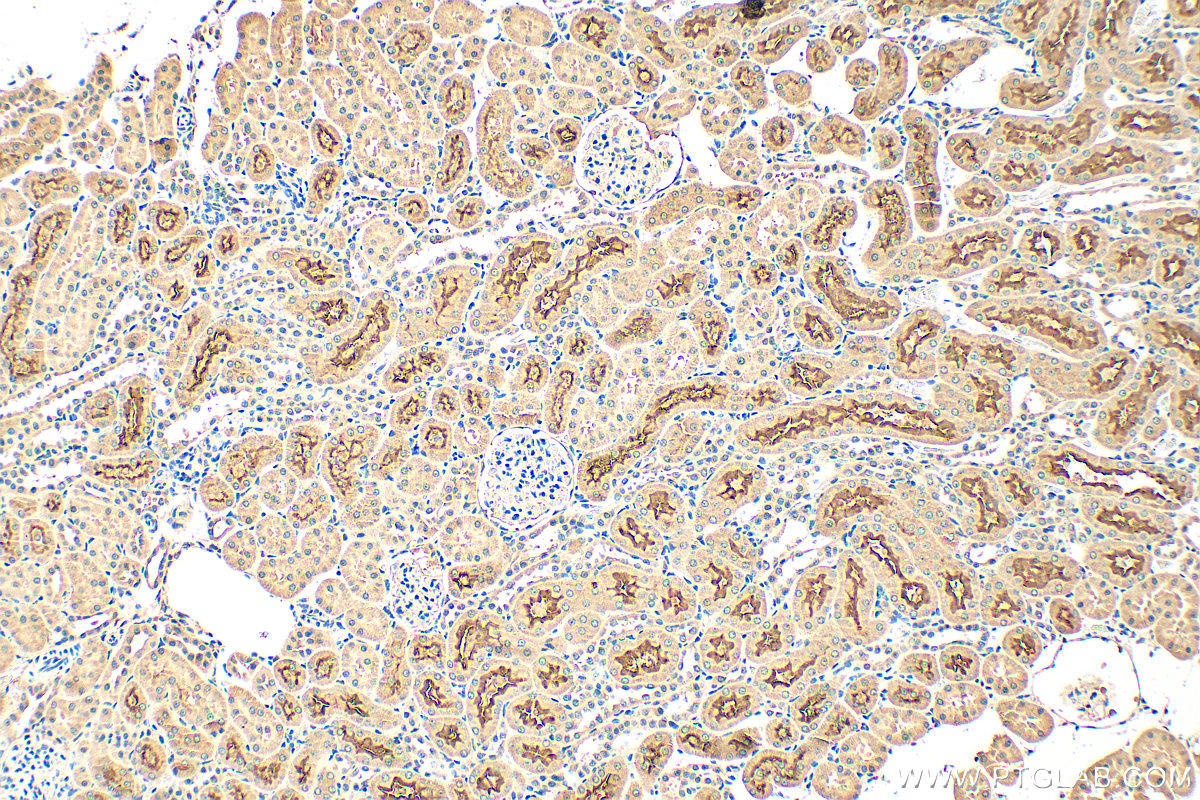 IHC staining of rat kidney using 21433-1-AP