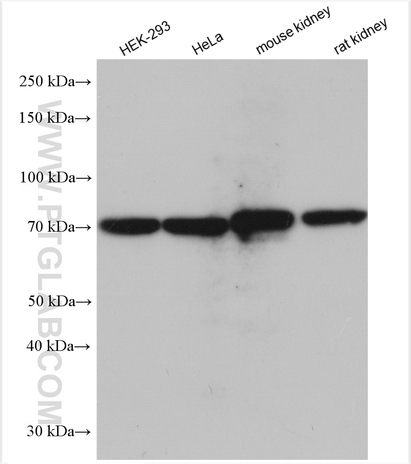 WB analysis using 29827-1-AP