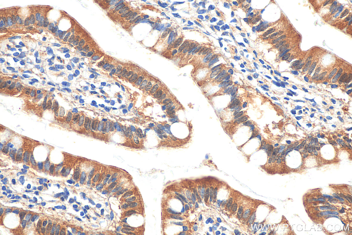 IHC staining of human small intestine using 27575-1-AP