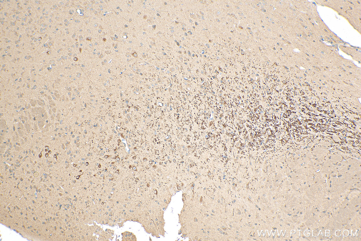 IHC staining of mouse brain using 22524-1-AP