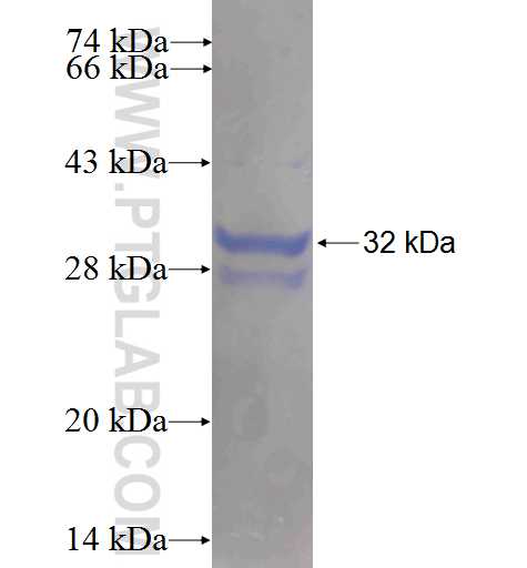 SLC6A6 fusion protein Ag24935 SDS-PAGE