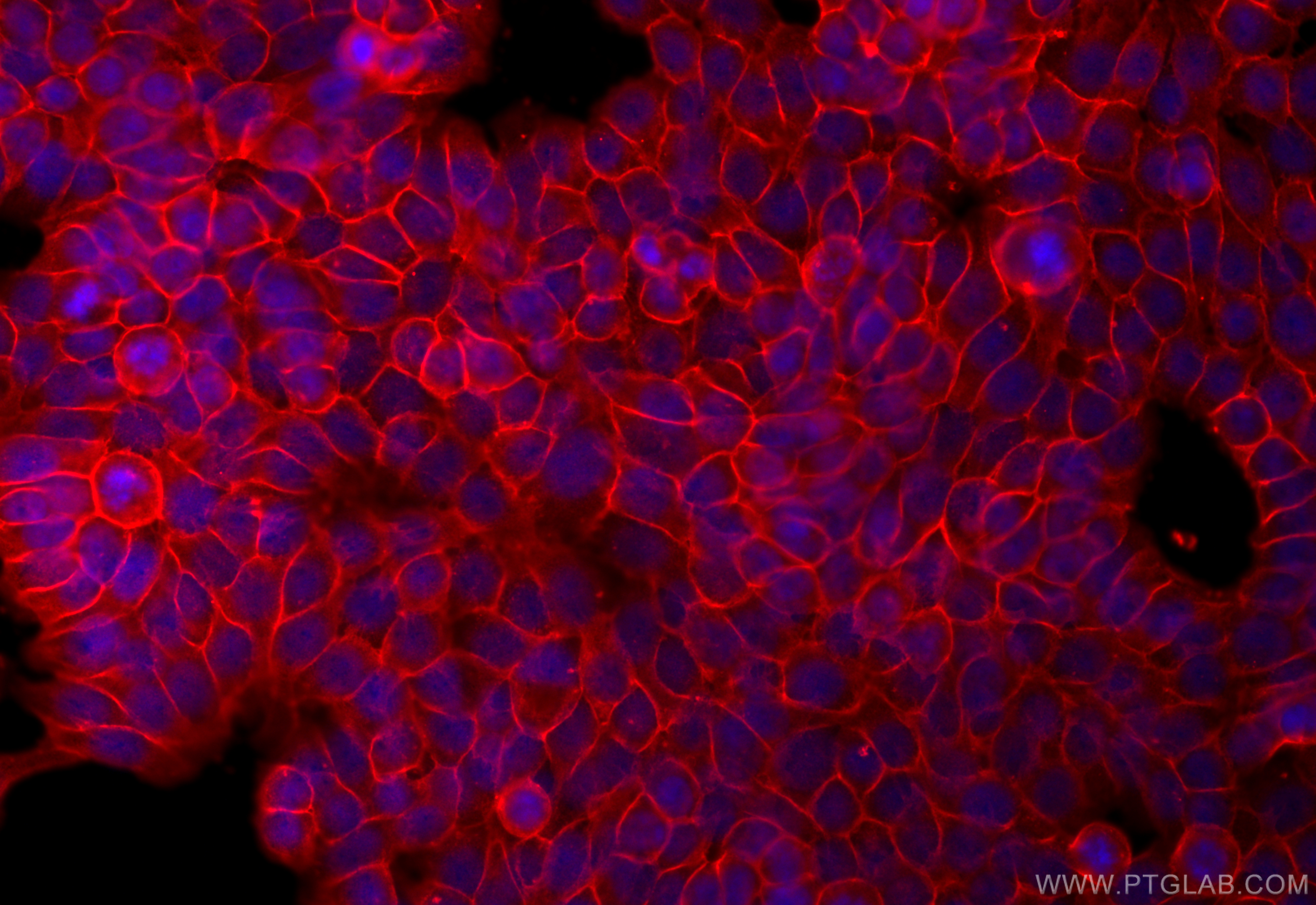 IF Staining of HT-29 using 28670-1-AP