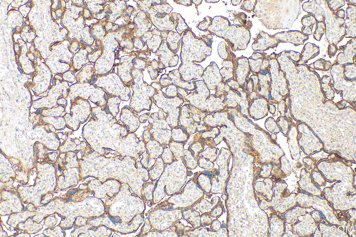 IHC staining of human placenta using 28670-1-AP