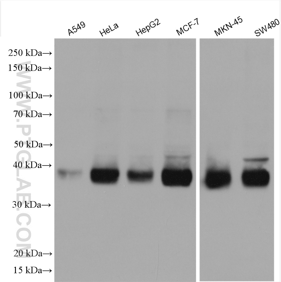 WB analysis using 28670-1-AP