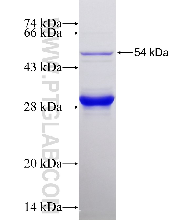 SLC9A3 fusion protein Ag25637 SDS-PAGE