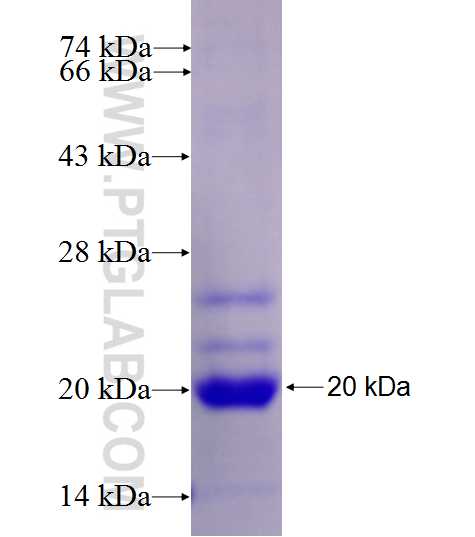 SLC9A5 fusion protein Ag27433 SDS-PAGE