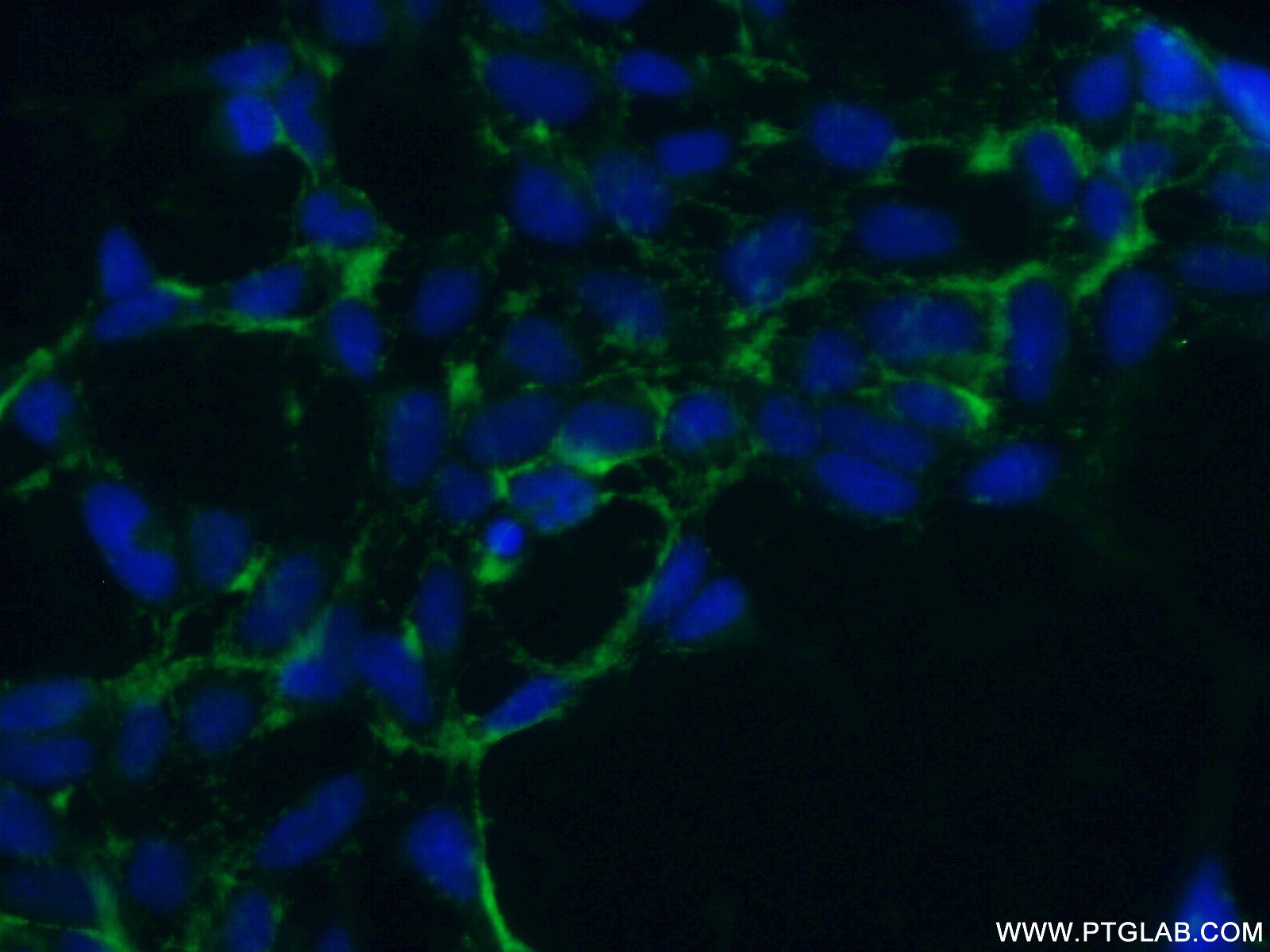 IF Staining of HEK-293 using 18318-1-AP