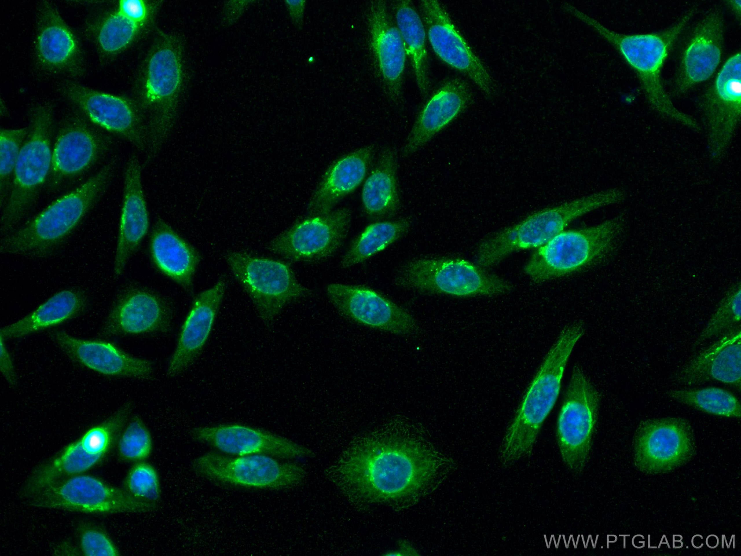 IF Staining of HepG2 using 66381-1-Ig (same clone as 66381-1-PBS)