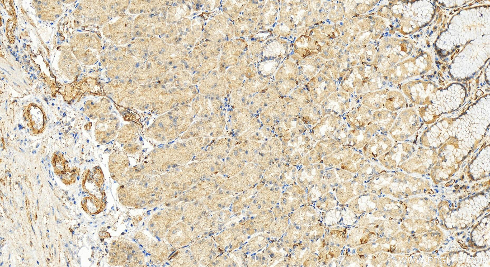 IHC staining of human stomach using 14327-1-AP