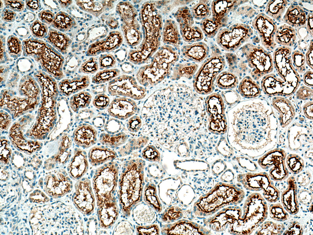 IHC staining of human kidney using 24584-1-AP