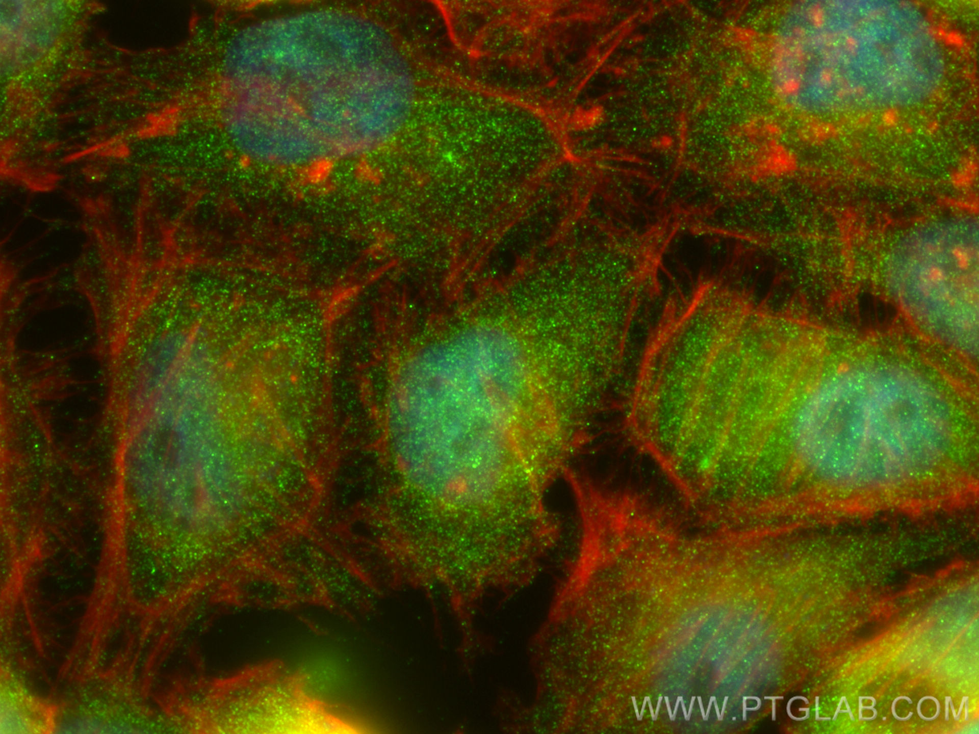 IF Staining of HeLa using 13315-1-AP