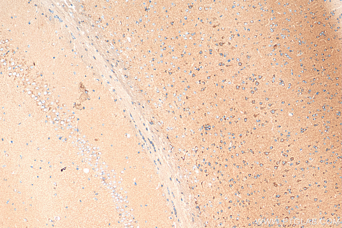 IHC staining of mouse brain using 21119-1-AP