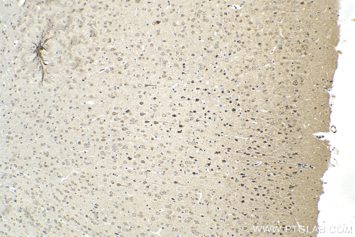 IHC staining of mouse brain using 21649-1-AP