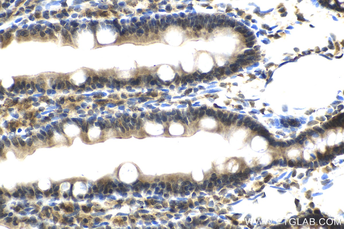 IHC staining of rat small intestine using 21649-1-AP