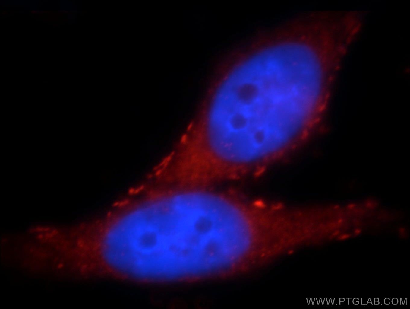 IF Staining of HepG2 using 21150-1-AP