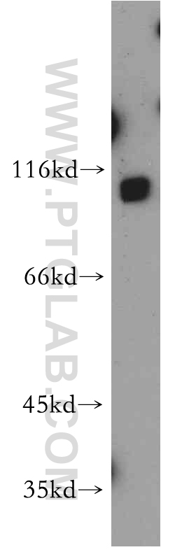 WB analysis of A549 using 21150-1-AP