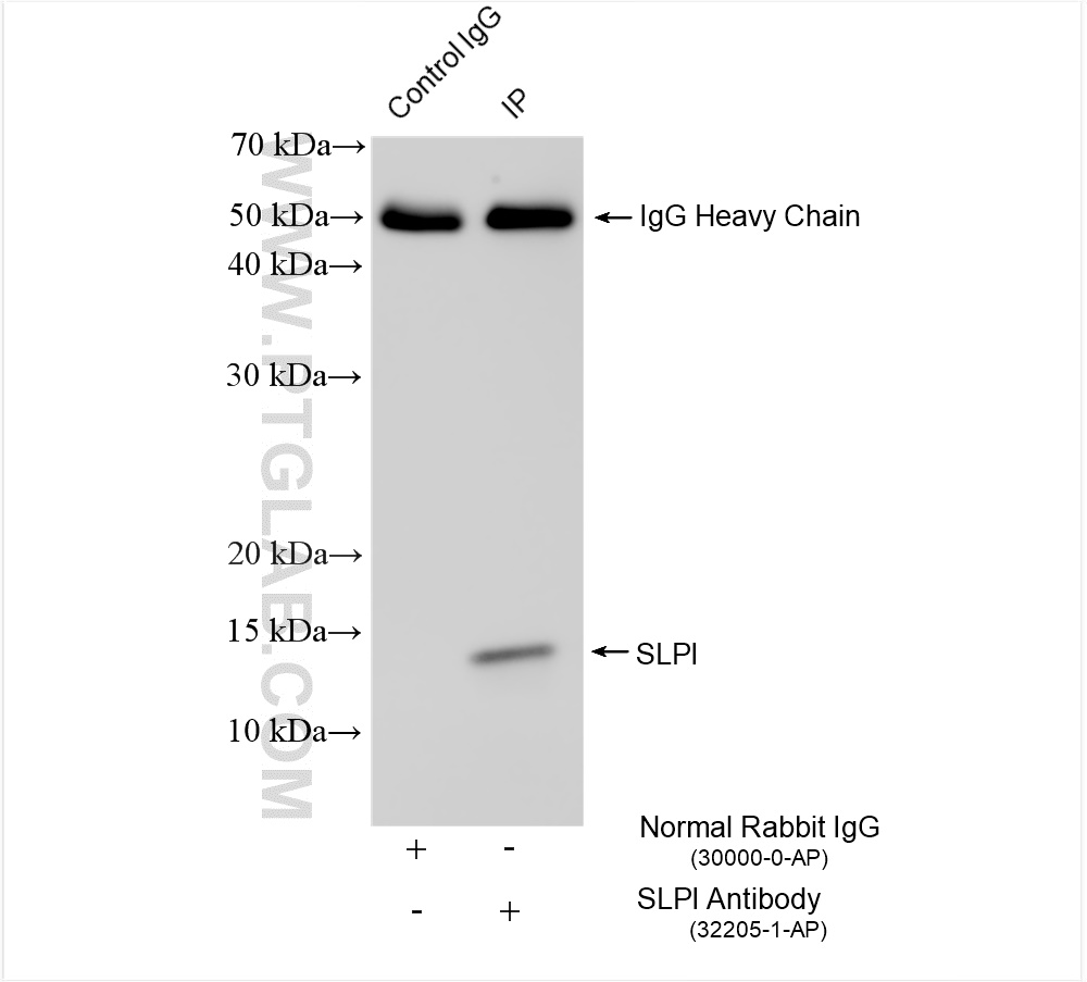 IP experiment of HeLa using 32205-1-AP