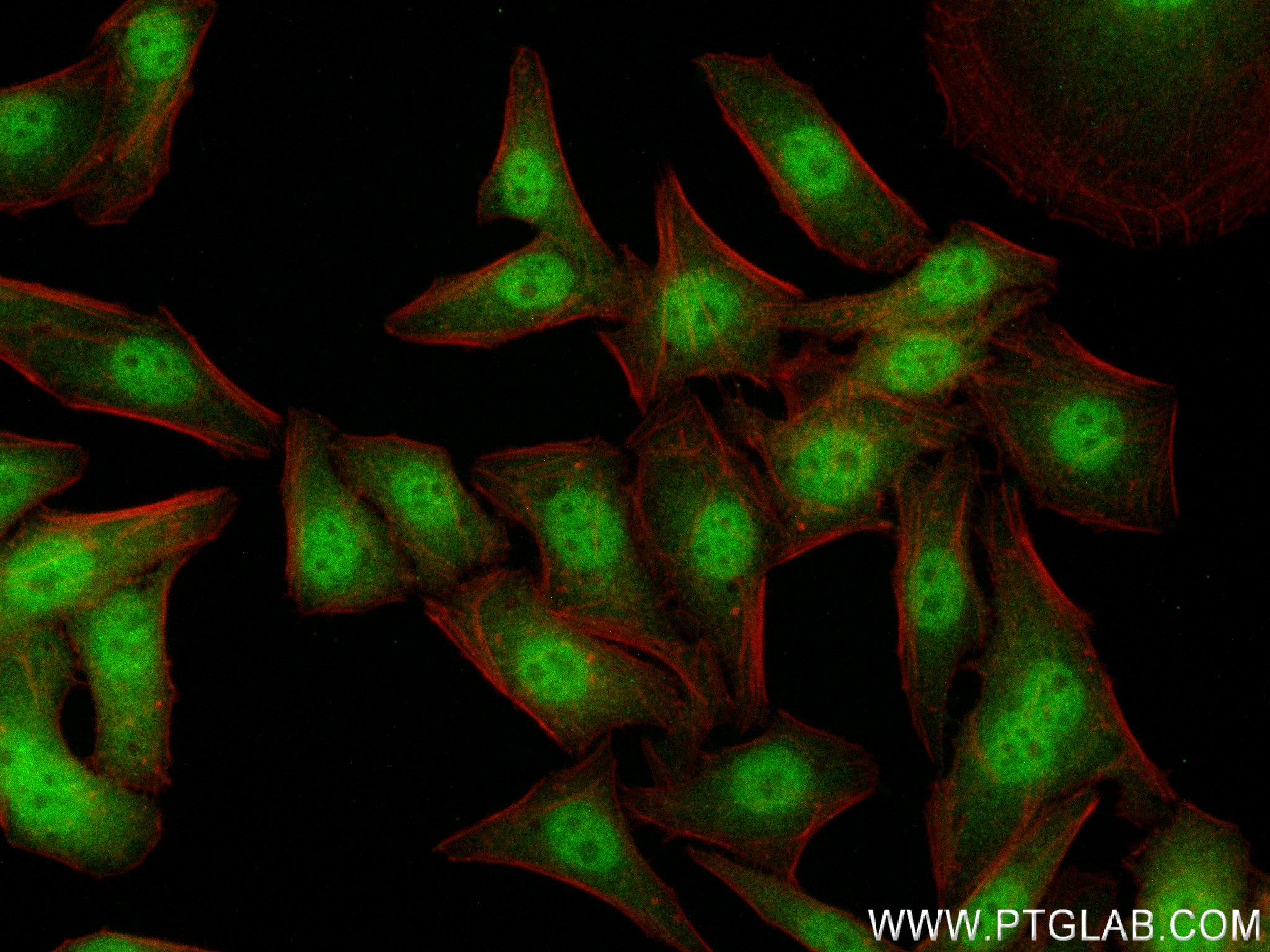 IF Staining of HepG2 using 83841-5-RR (same clone as 83841-5-PBS)