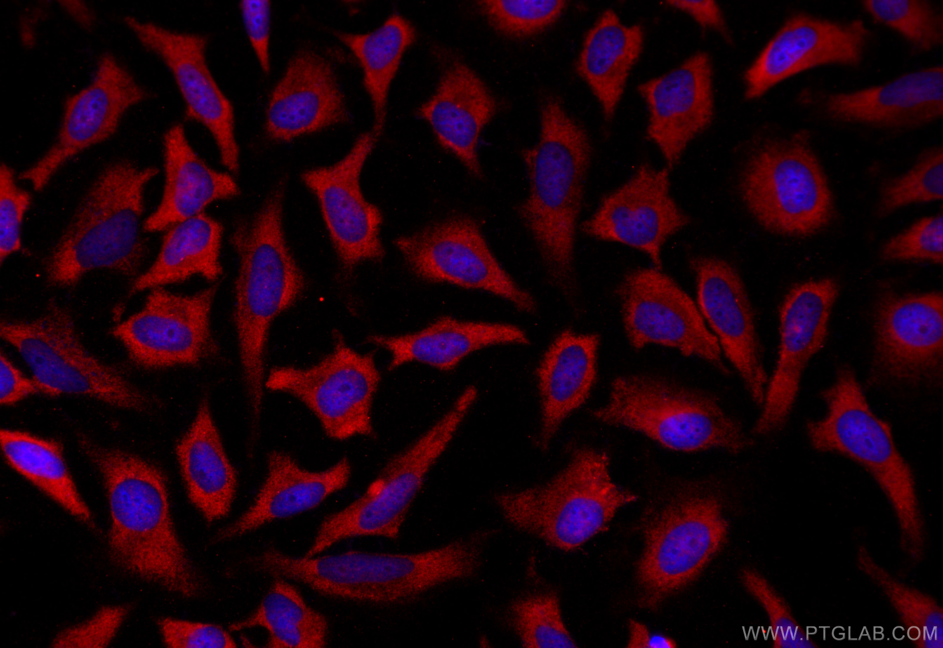 IF Staining of HeLa using 25494-1-AP