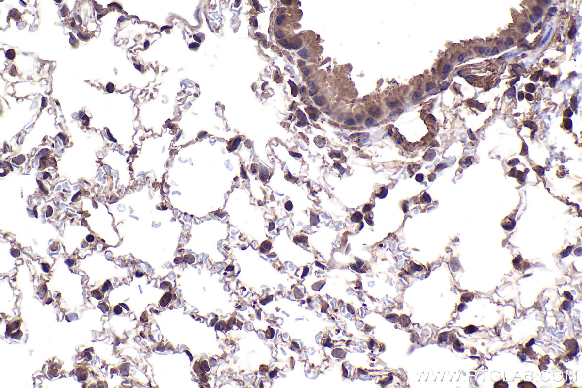 IHC staining of mouse lung using 66516-1-Ig