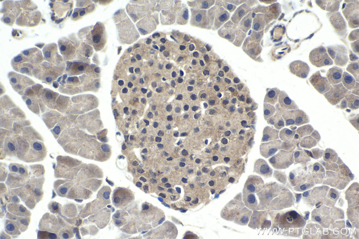 IHC staining of mouse pancreas using 10231-1-AP