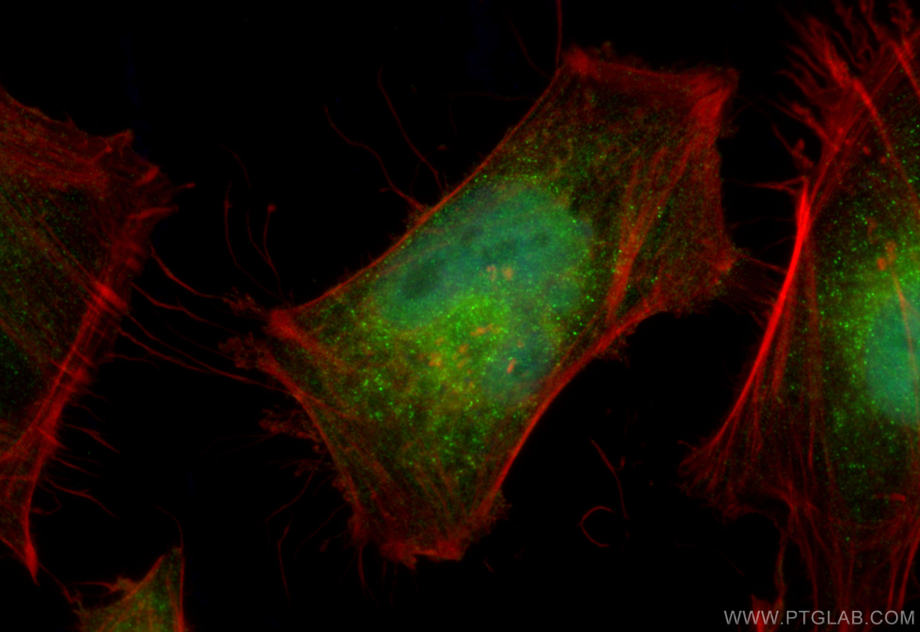 IF Staining of HeLa using 12167-1-AP