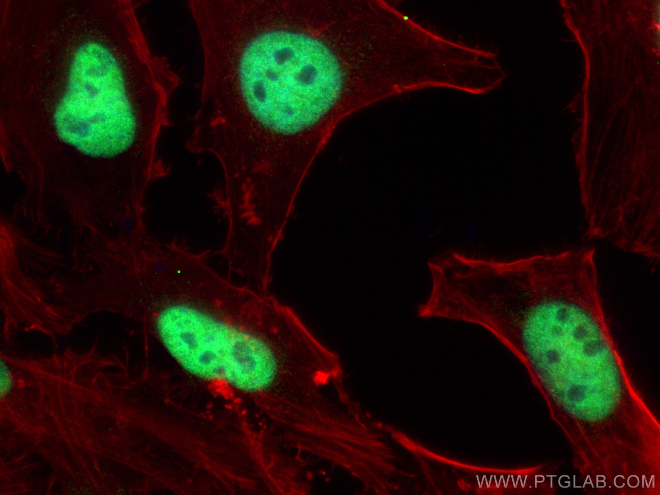 IF Staining of HeLa using 26613-1-AP