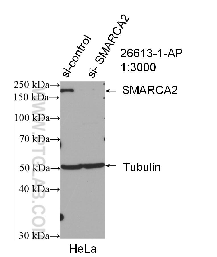 WB analysis of HeLa using 26613-1-AP